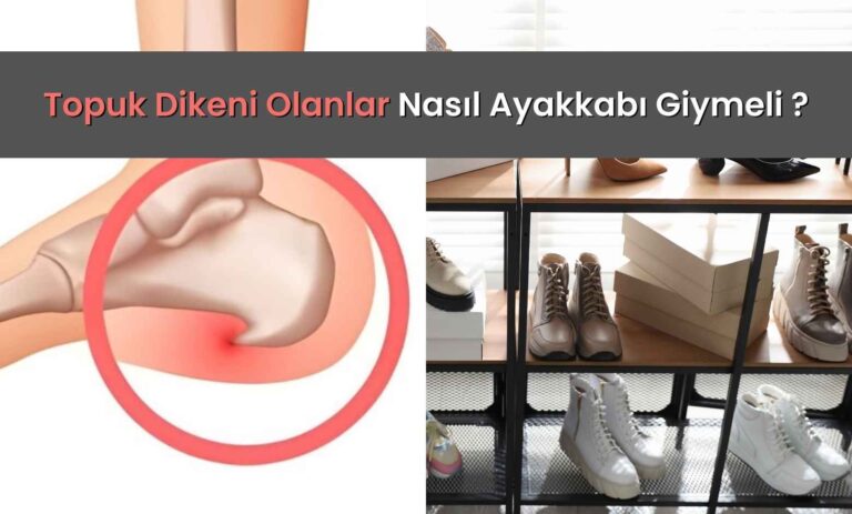 Topuk Dikeni Olanlar Nasıl Ayakkabı Giymeli?