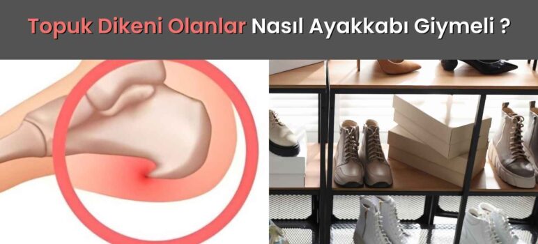 Topuk Dikeni Olanlar Nasıl Ayakkabı Giymeli ?