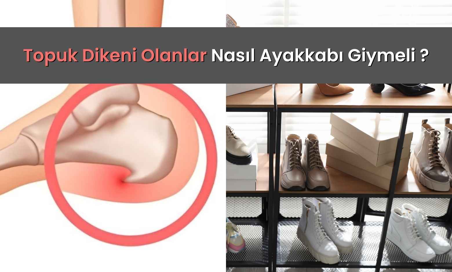 Topuk Dikeni Olanlar Nasıl Ayakkabı Giymeli?